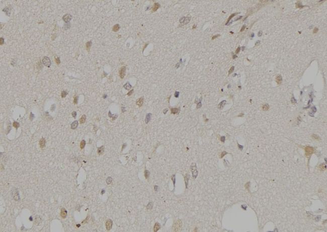 NCF2 / NOXA2 / p67phox Antibody - 1:100 staining human brain tissue by IHC-P. The sample was formaldehyde fixed and a heat mediated antigen retrieval step in citrate buffer was performed. The sample was then blocked and incubated with the antibody for 1.5 hours at 22°C. An HRP conjugated goat anti-rabbit antibody was used as the secondary.