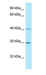 NCK1 / NCK Antibody - NCK1 / NCK antibody Western Blot of NCI-H226.  This image was taken for the unconjugated form of this product. Other forms have not been tested.