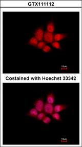 NCK1 / NCK Antibody - Immunofluorescence of paraformaldehyde-fixed A431, using NCK1 antibody at 1:500 dilution.