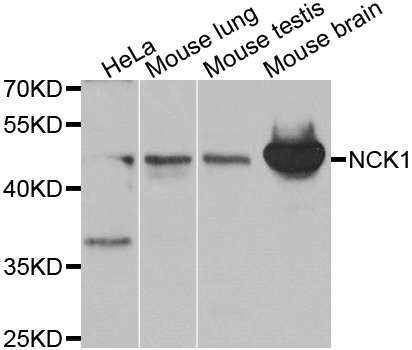 NCK1 / NCK Antibody - Western blot analysis of extracts of various cell lines.