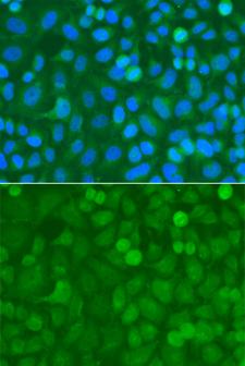 NCK1 / NCK Antibody - Immunofluorescence analysis of A549 cells using NCK1 antibody. Blue: DAPI for nuclear staining.
