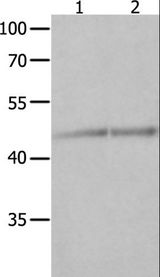 NCK1 / NCK Antibody - Western blot analysis of Jurkat and K562 cell, using NCK1 Polyclonal Antibody at dilution of 1:600.