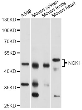 NCK1 / NCK Antibody - Western blot analysis of extracts of various cell lines, using NCK1 antibody at 1:1000 dilution. The secondary antibody used was an HRP Goat Anti-Rabbit IgG (H+L) at 1:10000 dilution. Lysates were loaded 25ug per lane and 3% nonfat dry milk in TBST was used for blocking. An ECL Kit was used for detection and the exposure time was 60s.