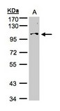 NCKAP1 / NAP125 Antibody - Sample (30g whole cell lysate). A: Hep G2 . 7.5% SDS PAGE. NCKAP1 / NAP125 antibody diluted at 1:500