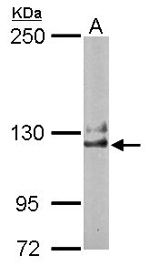NCKAP1 / NAP125 Antibody - Sample (50 ug of whole cell lysate). A: Mouse brain. 5% SDS PAGE. NCKAP1 / NAP125 antibody diluted at 1:1000.