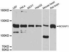 NCKAP1 / NAP125 Antibody - Western blot analysis of extracts of various cell lines, using NCKAP1 antibody at 1:3000 dilution. The secondary antibody used was an HRP Goat Anti-Rabbit IgG (H+L) at 1:10000 dilution. Lysates were loaded 25ug per lane and 3% nonfat dry milk in TBST was used for blocking. An ECL Kit was used for detection and the exposure time was 10s.