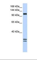 NCKAP1L Antibody - 293T cell lysate. Antibody concentration: 1.0 ug/ml. Gel concentration: 6-18%.  This image was taken for the unconjugated form of this product. Other forms have not been tested.
