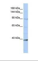 NCKAP1L Antibody - Jurkat cell lysate. Antibody concentration: 1.0 ug/ml. Gel concentration: 6-18%.  This image was taken for the unconjugated form of this product. Other forms have not been tested.