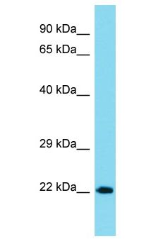 NCKAP5 Antibody - NCKAP5 antibody Western Blot of MCF7. Antibody dilution: 1 ug/ml.  This image was taken for the unconjugated form of this product. Other forms have not been tested.