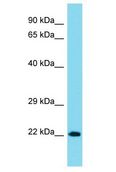 NCKAP5 Antibody - NCKAP5 antibody Western Blot of MCF7. Antibody dilution: 1 ug/ml.  This image was taken for the unconjugated form of this product. Other forms have not been tested.