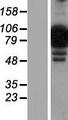 NCKIPSD / AF3P21 Protein - Western validation with an anti-DDK antibody * L: Control HEK293 lysate R: Over-expression lysate