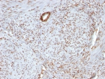 NCL / Nucleolin Antibody - Formalin-fixed, paraffin-embedded human uterus stained with Nucleolin antibody.  This image was taken for the unmodified form of this product. Other forms have not been tested.