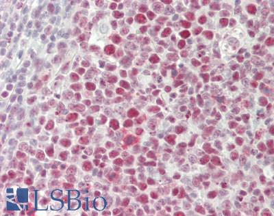 NCL / Nucleolin Antibody - Human Tonsil: Formalin-Fixed, Paraffin-Embedded (FFPE)