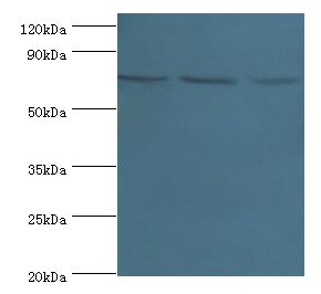 NCL / Nucleolin Antibody - Western blot. All lanes: NCL antibody at 4 ug/ml. Lane 1: Jurkat whole cell lysate. Lane 2: HeLa whole cell lysate. Lane 3: 293T whole cell lysate. Secondary antibody: Goat polyclonal to rabbit at 1:10000 dilution. Predicted band size: 77 kDa. Observed band size: 77 kDa.