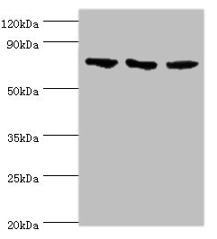 NCL / Nucleolin Antibody - Western blot All lanes: NCL antibody at 4µg/ml Lane 1: Jurkat whole cell lysate Lane 2: Hela whole cell lysate Lane 3: 293T whole cell lysate Secondary Goat polyclonal to rabbit IgG at 1/10000 dilution Predicted band size: 77 kDa Observed band size: 77 kDa