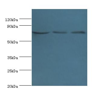 NCL / Nucleolin Antibody - Western blot. All lanes: NCL antibody at 8 ug/ml. Lane 1: Jurkat whole cell lysate. Lane 2: HeLa whole cell lysate. Lane 3: 293T whole cell lysate. Secondary antibody: Goat polyclonal to rabbit at 1:10000 dilution. Predicted band size: 77 kDa. Observed band size: 77 kDa.