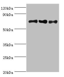 NCL / Nucleolin Antibody - Western blot All lanes: NCL antibody at 8µg/ml Lane 1: Jurkat whole cell lysate Lane 2: Hela whole cell lysate Lane 3: 293T whole cell lysate Secondary Goat polyclonal to rabbit IgG at 1/10000 dilution Predicted band size: 77 kDa Observed band size: 77 kDa