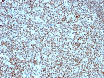 NCL / Nucleolin Antibody - Formalin-fixed paraffin-embedded human tonsil stained with NCL antibody (364-5).  This image was taken for the unmodified form of this product. Other forms have not been tested.