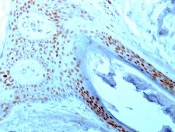 NCL / Nucleolin Antibody - Formalin-fixed paraffin-embedded human skin stained with NCL antibody (364-5).  This image was taken for the unmodified form of this product. Other forms have not been tested.