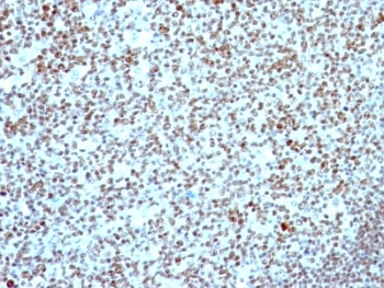 NCL / Nucleolin Antibody - Formalin-fixed, paraffin-embedded human tonsil stained with Nucleolin antibody.  This image was taken for the unmodified form of this product. Other forms have not been tested.