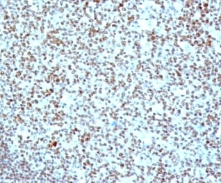 NCL / Nucleolin Antibody - Formalin-fixed, paraffin-embedded human tonsil stained with anti-Nucleolin antibody (SPM614).  This image was taken for the unmodified form of this product. Other forms have not been tested.