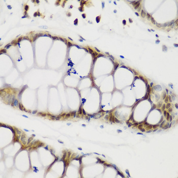 NCL / Nucleolin Antibody - Immunohistochemistry of paraffin-embedded human gastric tissue.