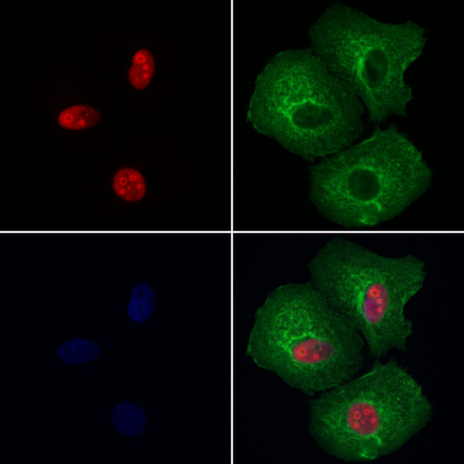 NCL / Nucleolin Antibody - Staining HeLa cells by IF/ICC. The samples were fixed with PFA and permeabilized in 0.1% Triton X-100, then blocked in 10% serum for 45 min at 25°C. Samples were then incubated with primary Ab(1:200) and mouse anti-beta tubulin Ab(1:200) for 1 hour at 37°C. An AlexaFluor594 conjugated goat anti-rabbit IgG(H+L) Ab(1:200 Red) and an AlexaFluor488 conjugated goat anti-mouse IgG(H+L) Ab(1:600 Green) were used as the secondary antibod