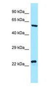 NCLN Antibody - NCLN antibody Western Blot of ACHN.  This image was taken for the unconjugated form of this product. Other forms have not been tested.