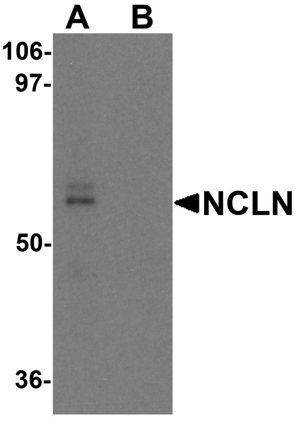 NCLN Antibody - Western blot analysis of NCLN in mouse heart tissue lysate with NCLN antibody at 0.5 ug/ml in (A) the absence and (B) the presence of blocking peptide.