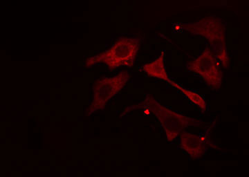 NCLN Antibody - Staining HepG2 cells by IF/ICC. The samples were fixed with PFA and permeabilized in 0.1% Triton X-100, then blocked in 10% serum for 45 min at 25°C. The primary antibody was diluted at 1:200 and incubated with the sample for 1 hour at 37°C. An Alexa Fluor 594 conjugated goat anti-rabbit IgG (H+L) antibody, diluted at 1/600, was used as secondary antibody.