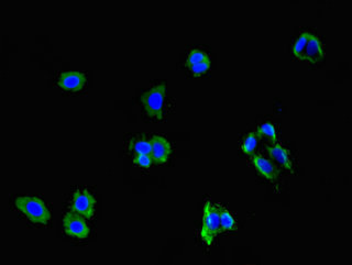 NCMAP / C1orf130 Antibody - Immunofluorescent analysis of HepG2 cells using NCMAP Antibody at dilution of 1:100 and Alexa Fluor 488-congugated AffiniPure Goat Anti-Rabbit IgG(H+L)