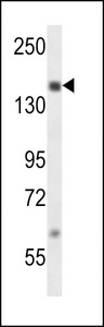 NCOA1 / SRC-1 Antibody - SRC1 Antibody western blot of MDA-MB231 cell line lysates (35 ug/lane). The SRC1 antibody detected the SRC1 protein (arrow).