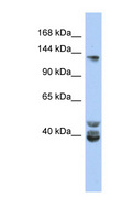 NCOA1 / SRC-1 Antibody - NCOA1 antibody Western blot of NCI-H226 cell lysate. This image was taken for the unconjugated form of this product. Other forms have not been tested.