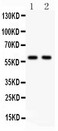 NCOA1 / SRC-1 Antibody - KAT13A antibody Western blot. All lanes: Anti KAT13A at 0.5 ug/ml. Lane 1: COLO320 Whole Cell Lysate at 40 ug. Lane 2: A549 Whole Cell Lysate at 40 ug. Predicted band size: 60 kD. Observed band size: 60 kD.