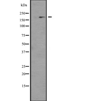 NCOA1 / SRC-1 Antibody - Western blot analysis of NCOA1 expression in KAT13A/SRC1 transfected 293 cells line lysate. The lane on the left is treated with the antigen-specific peptide.