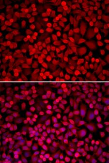 NCOA1 / SRC-1 Antibody - Immunofluorescence analysis of U2OS cells using NCOA1 Polyclonal Antibody.