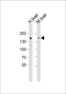 NCOA2 / TIF2 Antibody - Western blot of lysates from human liver, mouse liver tissue lysate (from left to right) with NCOA2 Antibody. Antibody was diluted at 1:1000 at each lane. A goat anti-rabbit IgG H&L (HRP) at 1:10000 dilution was used as the secondary antibody. Lysates at 20 ug per lane.