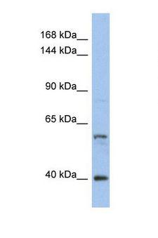 NCOA2 / TIF2 Antibody - Western blot of Human HT1080. NCOA2 antibody dilution 1.0 ug/ml.  This image was taken for the unconjugated form of this product. Other forms have not been tested.