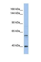 NCOA2 / TIF2 Antibody - Western blot of Human HT1080. NCOA2 antibody dilution 1.0 ug/ml.  This image was taken for the unconjugated form of this product. Other forms have not been tested.