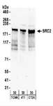 NCOA2 / TIF2 Antibody - Detection of Mouse SRC2 by Western Blot. Samples: Whole cell lysate (50 ug) from TCMK-1, 4T1, and CT26.WT cells. Antibodies: Affinity purified rabbit anti-SRC2 antibody used for WB at 1 ug/ml. Detection: Chemiluminescence with an exposure time of 3 minutes.