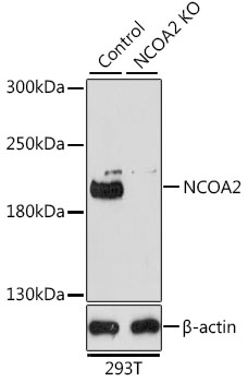 NCOA2 / TIF2 Antibody - Western blot analysis of extracts from normal (control) and NCOA2 knockout (KO) 293T cells, using NCOA2 antibodyat 1:1000 dilution. The secondary antibody used was an HRP Goat Anti-Rabbit IgG (H+L) at 1:10000 dilution. Lysates were loaded 25ug per lane and 3% nonfat dry milk in TBST was used for blocking. An ECL Kit was used for detection and the exposure time was 3min.