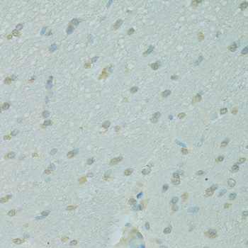 NCOA2 / TIF2 Antibody - Immunohistochemistry of paraffin-embedded rat brain using NCOA2 antibodyat dilution of 1:100 (40x lens).
