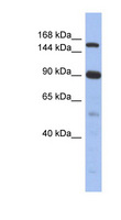 NCOA2 / TIF2 Antibody - NCOA2 antibody Western blot of Fetal Thymus lysate. This image was taken for the unconjugated form of this product. Other forms have not been tested.