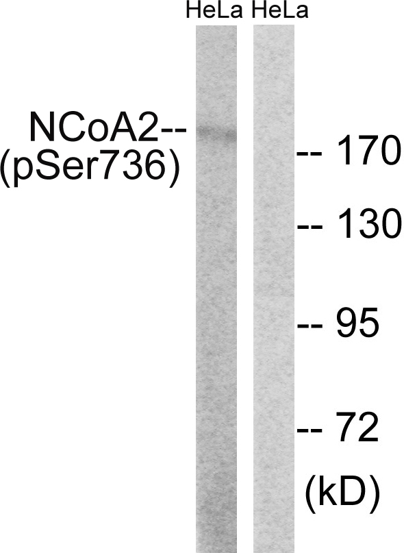 NCOA2 / TIF2 Antibody - Western blot analysis of lysates from HeLa cells treated with TSA 400nM 24H, using NCoA2 (Phospho-Ser736) Antibody. The lane on the right is blocked with the phospho peptide.