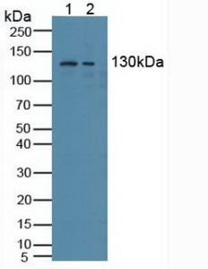 NCOA3 / SRC-3 / AIB1 Antibody - Western Blot; Sample: Lane1: Human Hela Cells; Lane2: Human K562 Cells.
