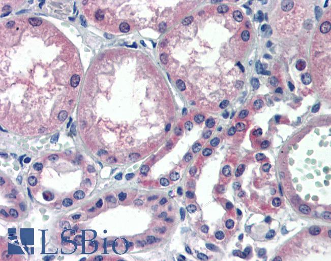 NCOA3 / SRC-3 / AIB1 Antibody - Kidney: Formalin-Fixed, Paraffin-Embedded (FFPE).  This image was taken for the unconjugated form of this product. Other forms have not been tested.