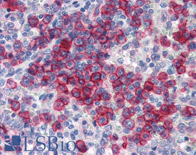 NCOA3 / SRC-3 / AIB1 Antibody - Anti-NCOA3 antibody IHC of human spleen. Immunohistochemistry of formalin-fixed, paraffin-embedded tissue after heat-induced antigen retrieval. Antibody concentration 5 ug/ml.  This image was taken for the unconjugated form of this product. Other forms have not been tested.