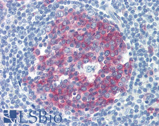 NCOA3 / SRC-3 / AIB1 Antibody - Anti-NCOA3 antibody IHC of human tonsil. Immunohistochemistry of formalin-fixed, paraffin-embedded tissue after heat-induced antigen retrieval. Antibody concentration 5 ug/ml.  This image was taken for the unconjugated form of this product. Other forms have not been tested.