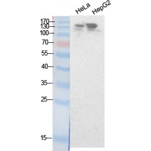 NCOA3 / SRC-3 / AIB1 Antibody - Western blot of NCoA-3 antibody