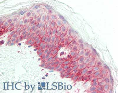 NCOA3 / SRC-3 / AIB1 Antibody - Immunohistochemistry of rabbit anti-NCOA3 antibody. Tissue: skin spleen. Fixation: formalin fixed paraffin embedded. Antigen retrieval: not required. Primary antibody: Anti-NCOA3 at 5 µg/mL for 1 h at RT. Secondary antibody: Peroxidase rabbit secondary antibody at 1:10,000 for 45 min at RT. Staining: NCOA-3 as precipitated red signal with hematoxylin purple nuclear counterstain.